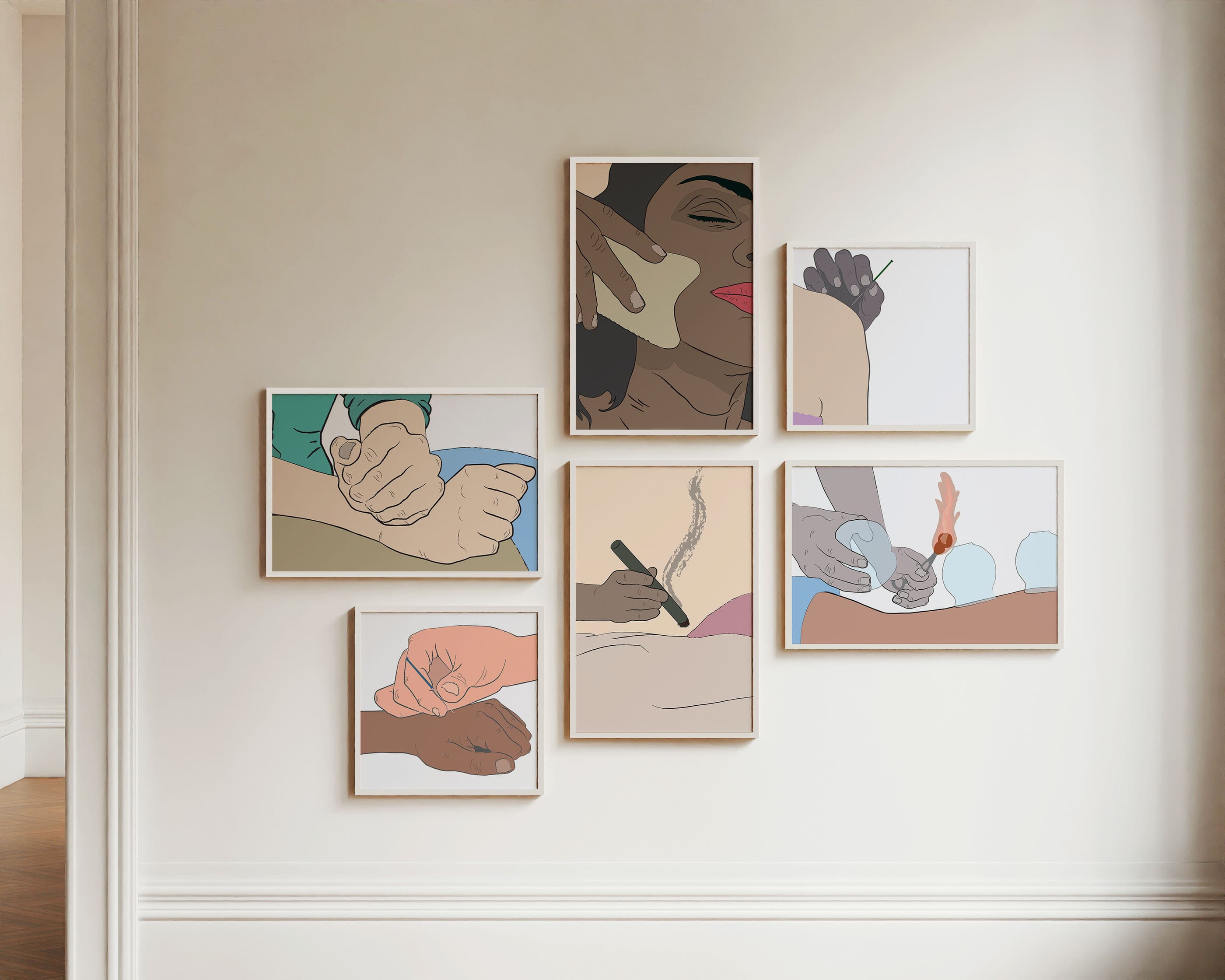 TCM Clinic Posters Bundle: Acupuncture, Moxa & Cupping (8)